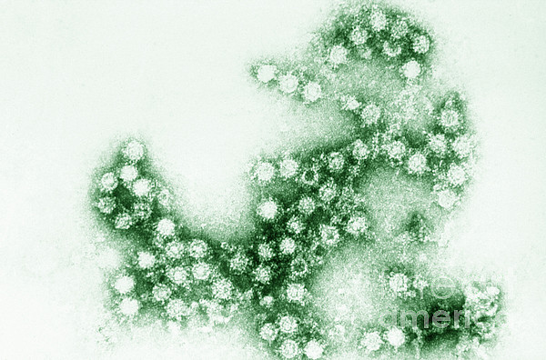 Confirma Salud 127 casos de virus Coxsackie